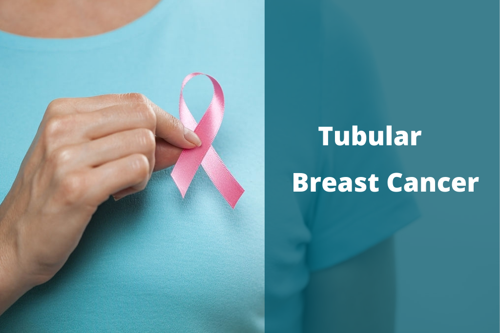 Tubular breast cancer